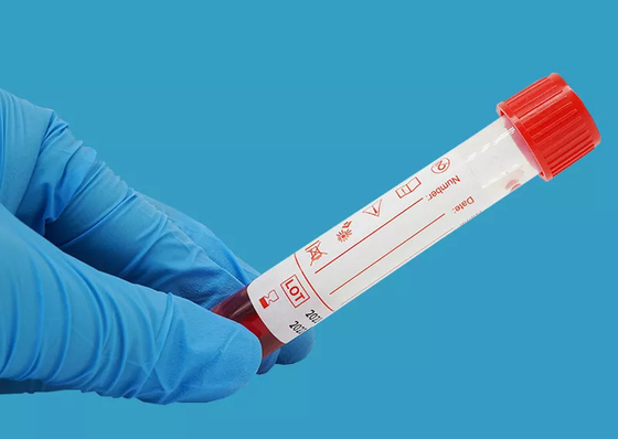 مجموعة استخراج عينات الفيروسات 10 مللي للاستعمال مرة واحدة