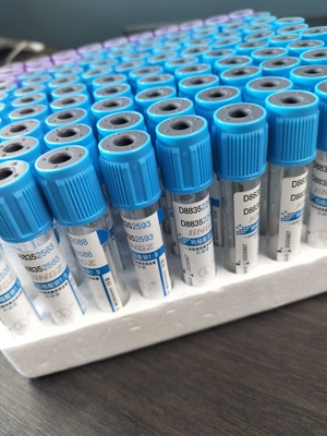 اختبار زجاجي مخصص لـ PET للطبيب سيترات الصوديوم 3.2% PT Tube 2-10ml أنبوب جمع الدم الفراغ